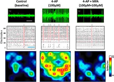 Antiseizure properties of fenamate NSAIDs determined in mature human stem-cell derived neuroglial circuits